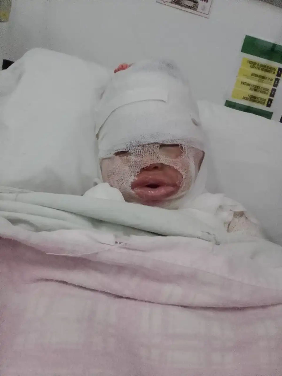 Una nena de tres años fue víctima de una inexplicable negligencia en un restaurante de la localidad bonaerense de Florencio Varela