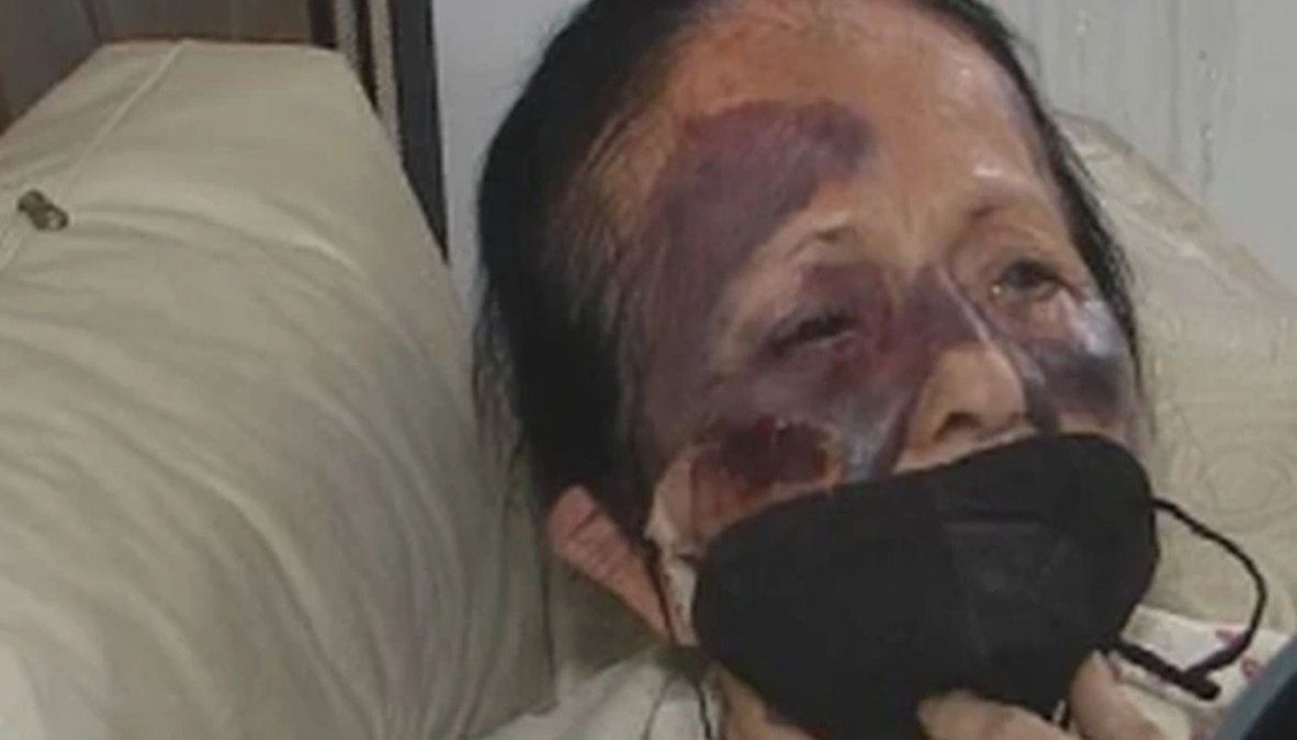  Robaron y golpearon salvajemente a una jubilada para robarle en San Martín: Me arrastraban de los pelos