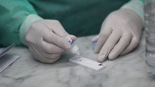 Un análisis de sangre podría detectar el Alzheimer antes de la demencia: la tecnología ya funciona en Argentina.