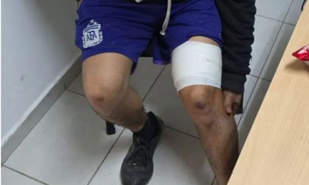 El joven terminó herido mientras se hacía un tatuaje. El joven terminó herido mientras se hacía un tatuaje.