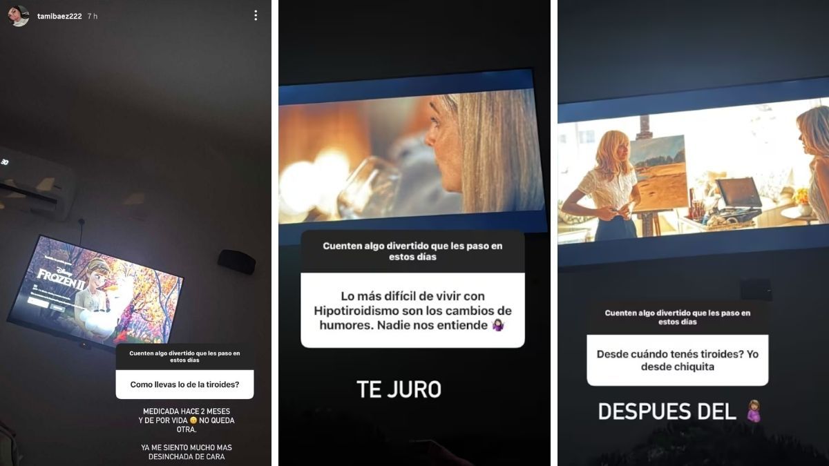 Tamara Báez habló de cómo es vivir con hipotiroidismo. Tamara Báez habló de cómo es vivir con hipotiroidismo.