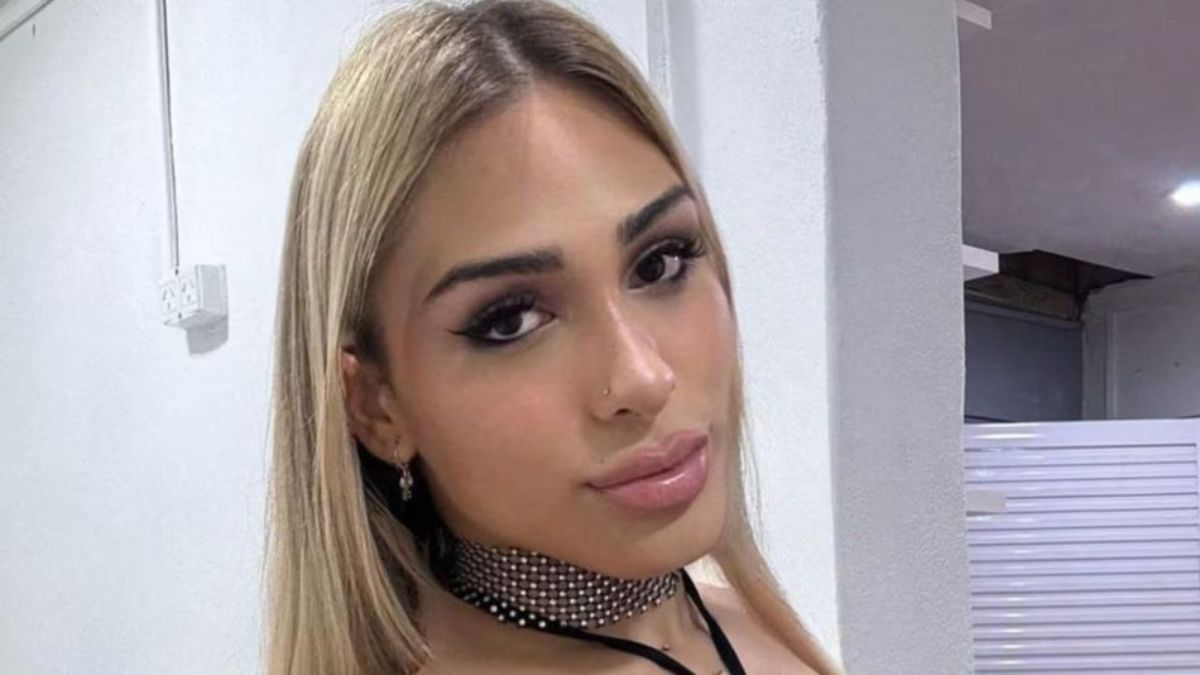 La influencer registró la evolución de los tratamientos faciales y adelantó que planifica una nueva cirugía plástica en los próximos meses.