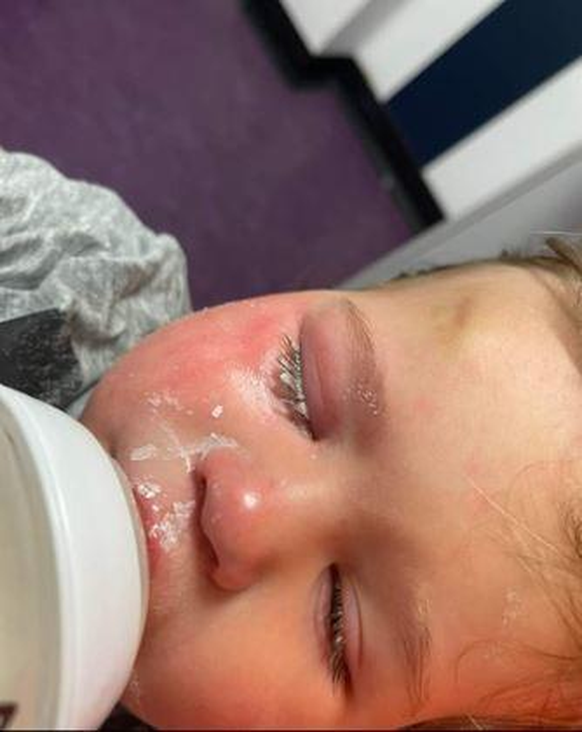 El nene está fuera de peligro y afortunadamente no le quedaron secuelas en la vista.