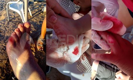 Dos personas, entre ellas un niño, sufrieron importantes heridas luego de meterse al río en la costanera de Coronda, donde había palometas. Dos personas, entre ellas un niño, sufrieron importantes heridas luego de meterse al río en la costanera de Coronda, donde había palometas.