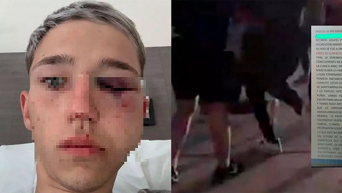 Imputarán a rugbiers salteños: desfiguraron a un chico a trompadas y lo dejaron al borde de la muerte