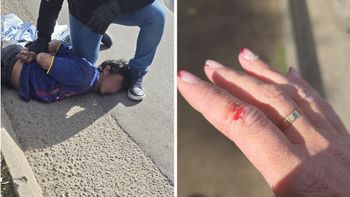 El hombre fue detenido por vecinos que auxiliaron a la mujer, quien resultó herida en su mano por el forcejeo.