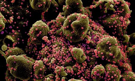 un virologo ruso pronostica como sera la segunda ola de la epidemia del covid-19 un virologo ruso pronostica como sera la segunda ola de la epidemia del covid-19