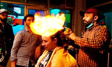 Vio en las redes un corte de pelo con fuego, intentó hacérselo a un amigo y lo dejó con graves quemaduras Vio en las redes un corte de pelo con fuego, intentó hacérselo a un amigo y lo dejó con graves quemaduras