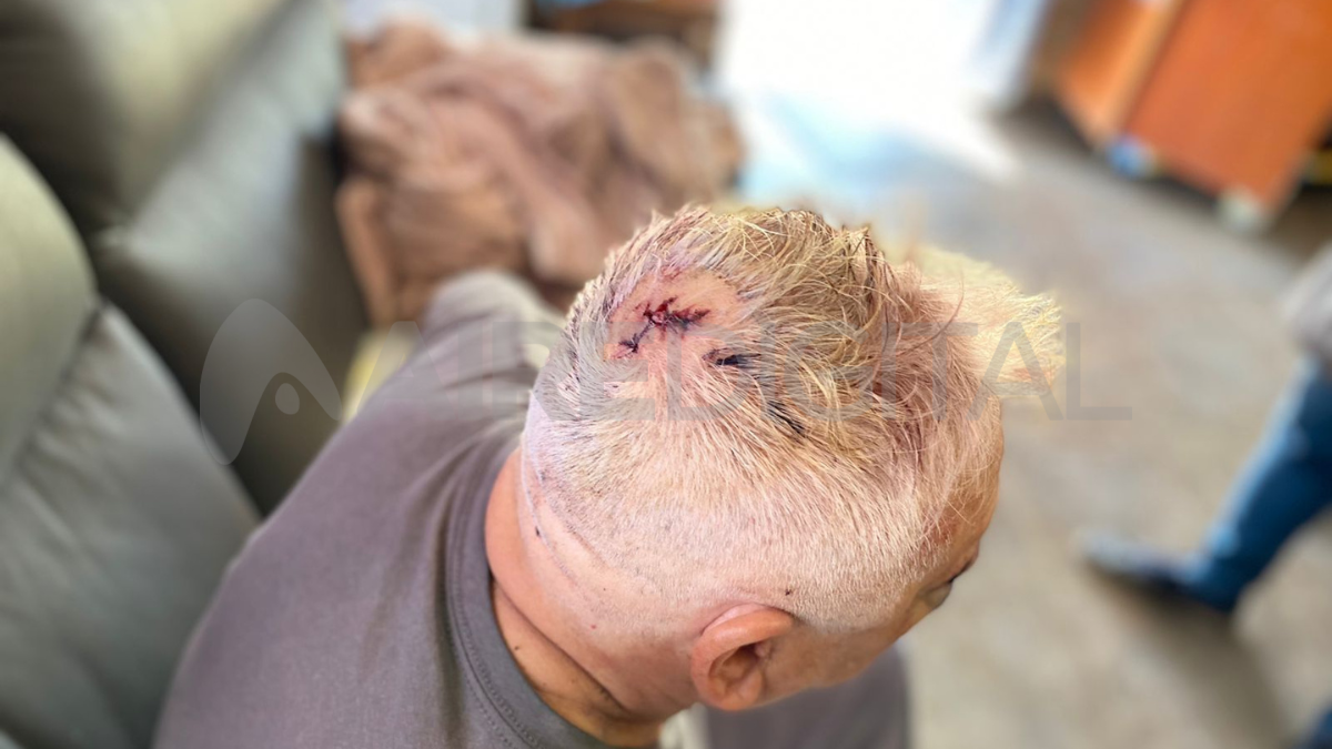 Uno de los ladrones golpeó salvajemente al hombre de 67 años que a raíz de los cortes perdió una importante cantidad de sangre.