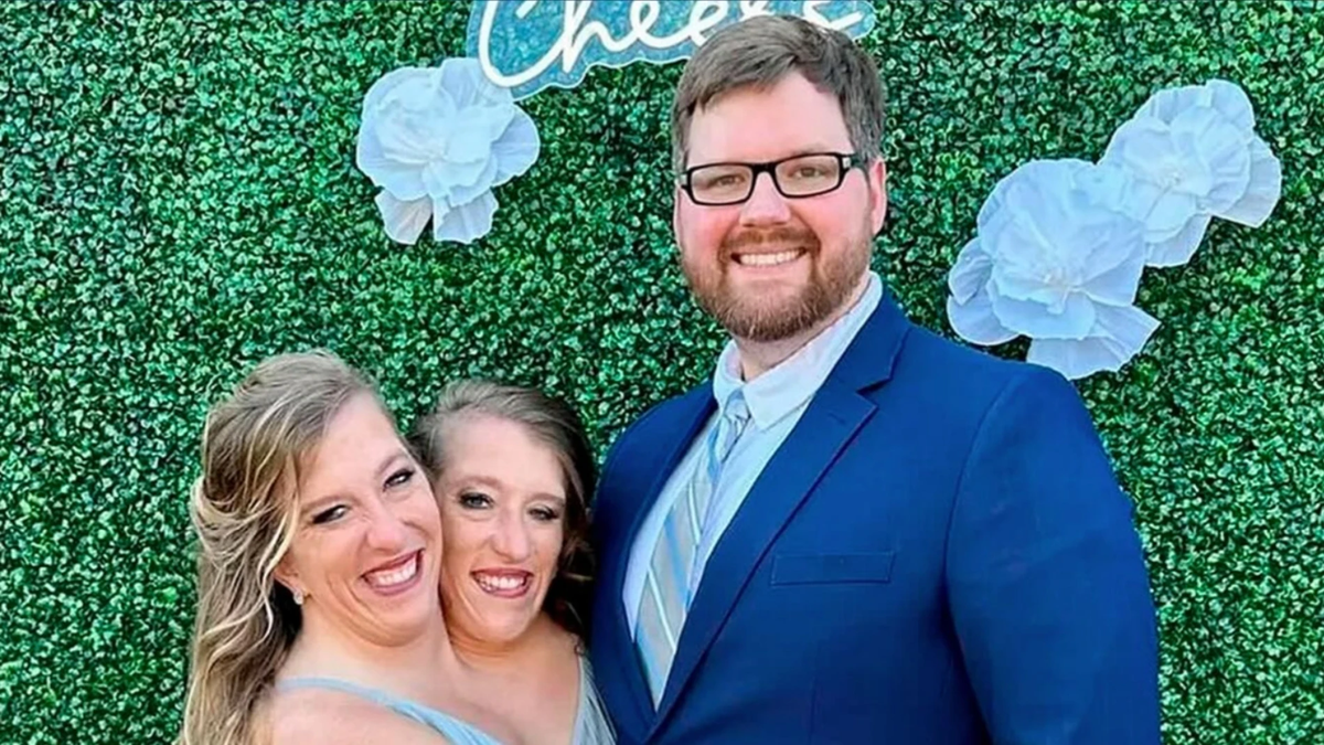 La siamesa Abby Hensel se casó: cuando el amor supera todos los obstáculos