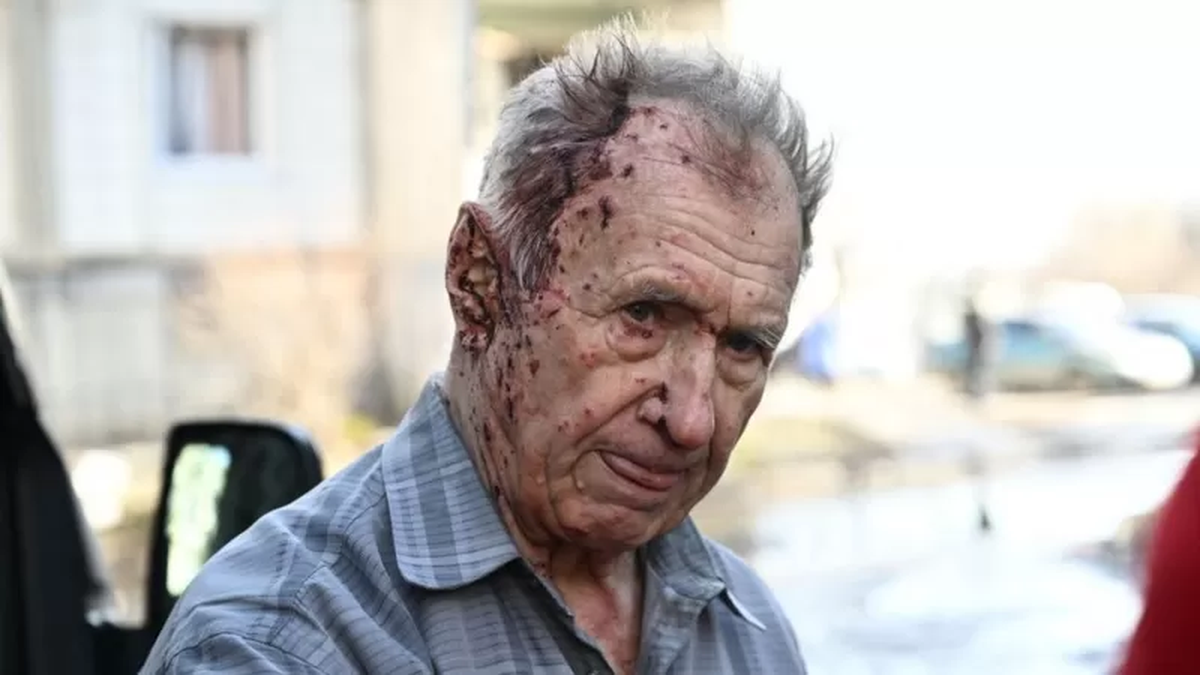 Este hombre, herido por los bombardeos en Chugúyev, espera ser atentido por los servicios de emergencia.- GETTY IMAGES