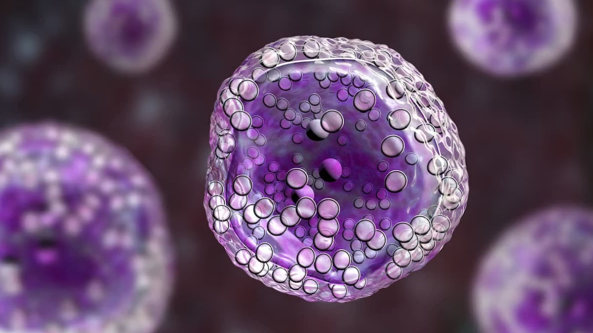 ANMAT aprobó un innovador tratamiento para un cáncer de sangre.