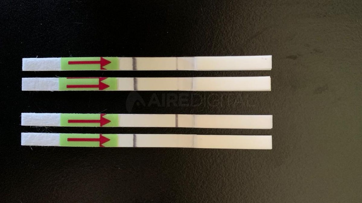 Argentinos crearon un método para detectar el coronavirus: es rápido, fácil de hacer y más económico