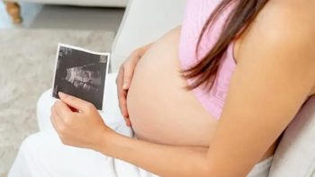 El extraño caso de una mujer que quedó embarazada de dos hombres al mismo tiempo