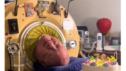 Murió Paul Alexander, el hombre que vivió durante más de 70 años conectado a un pulmón de hierro