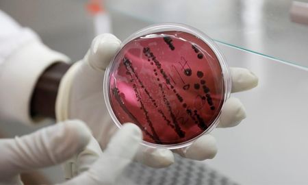 Investigadores de los Centros para el Control y la Prevención de Enfermedades (CDC) de EE.UU. descubrieron que un virus mortal llamado Chapare se puede contagiar de persona a persona Investigadores de los Centros para el Control y la Prevención de Enfermedades (CDC) de EE.UU. descubrieron que un virus mortal llamado Chapare se puede contagiar de persona a persona
