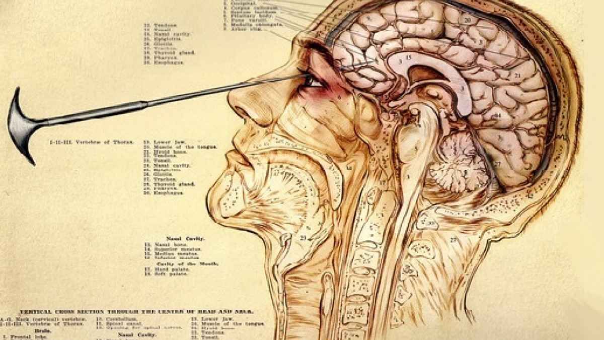 Una de las formas en las que se practicaba la lobotomía: introduciendo un instrumento por el ojo. El método de Watts se realizaba a través de las sienes con el paciente consciente. Una de las formas en las que se practicaba la lobotomía: introduciendo un instrumento por el ojo. El método de Watts se realizaba a través de las sienes con el paciente consciente.