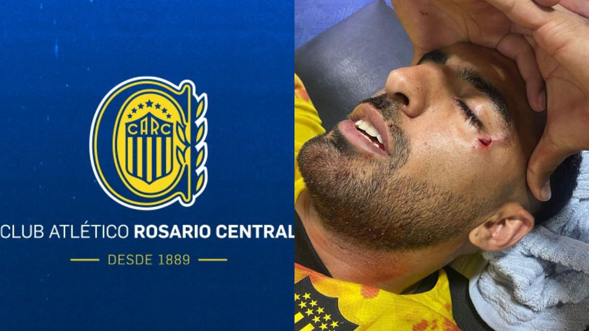 El comunicado oficial de Rosario Central tras la agresión a Maximiliano Olivera.