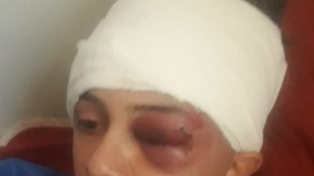 El estado en el que quedó el menor de los Burgos tras haber sido 'patoteado' por los Zuñiga. (FOTO: LA OPINIÓN AUSTRAL)