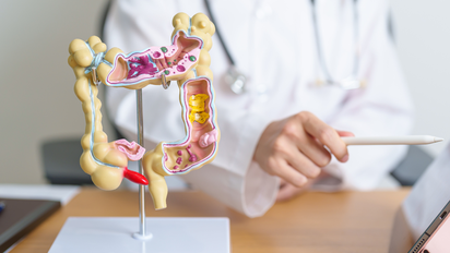 Prevención del cáncer de colon: estrategias para combatir la segunda causa de mortalidad en Argentina