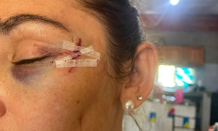 Detienen a dos mujeres por el brutal ataque a una vecina en San José del Rincón. Detienen a dos mujeres por el brutal ataque a una vecina en San José del Rincón.