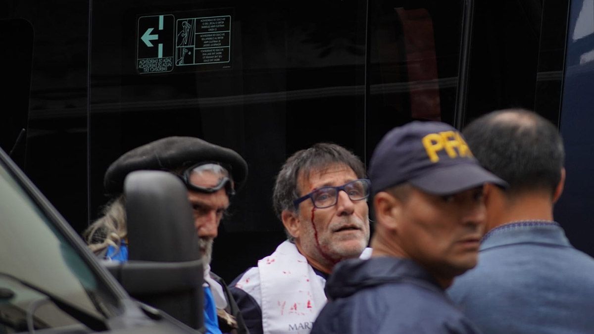 Olveira mostró su herida y expresó su desazón por la represión. Olveira mostró su herida y expresó su desazón por la represión.