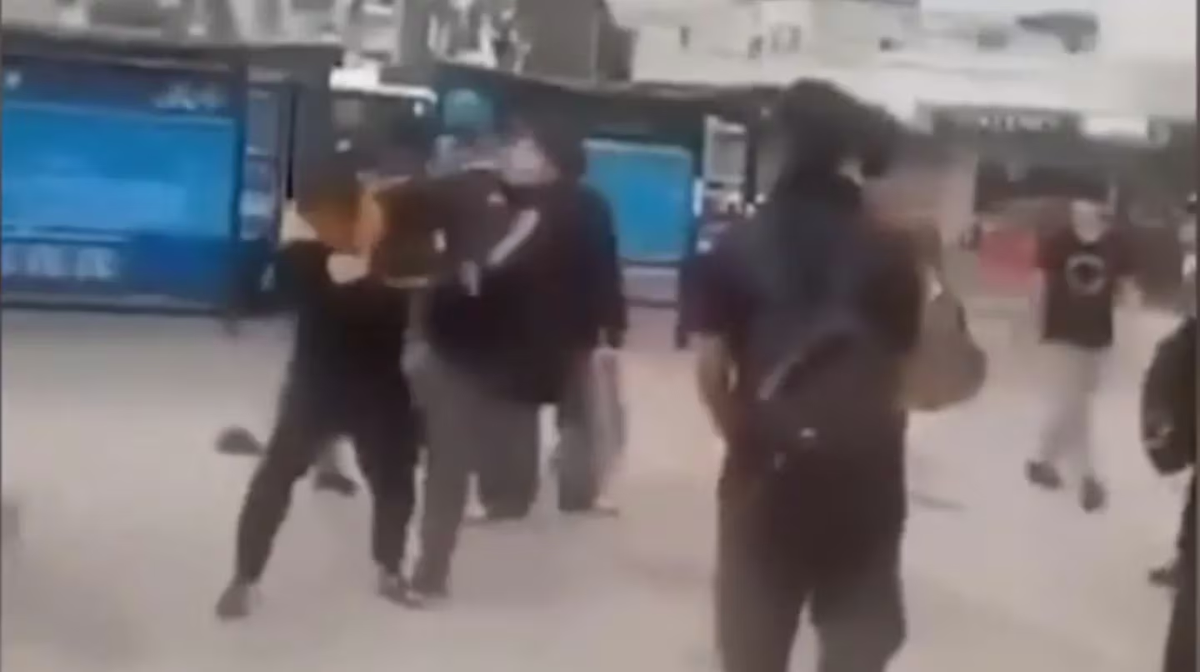 Brutal ataque a un adolescente de 13 años: le pegaron con un martillo por querer evitar un robo