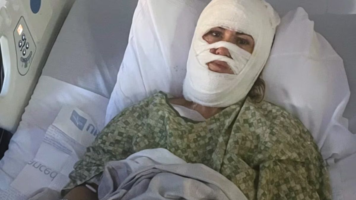 Sufrió quemaduras en gran parte del cuerpo luego de que un desconocido le arrojara ácido.