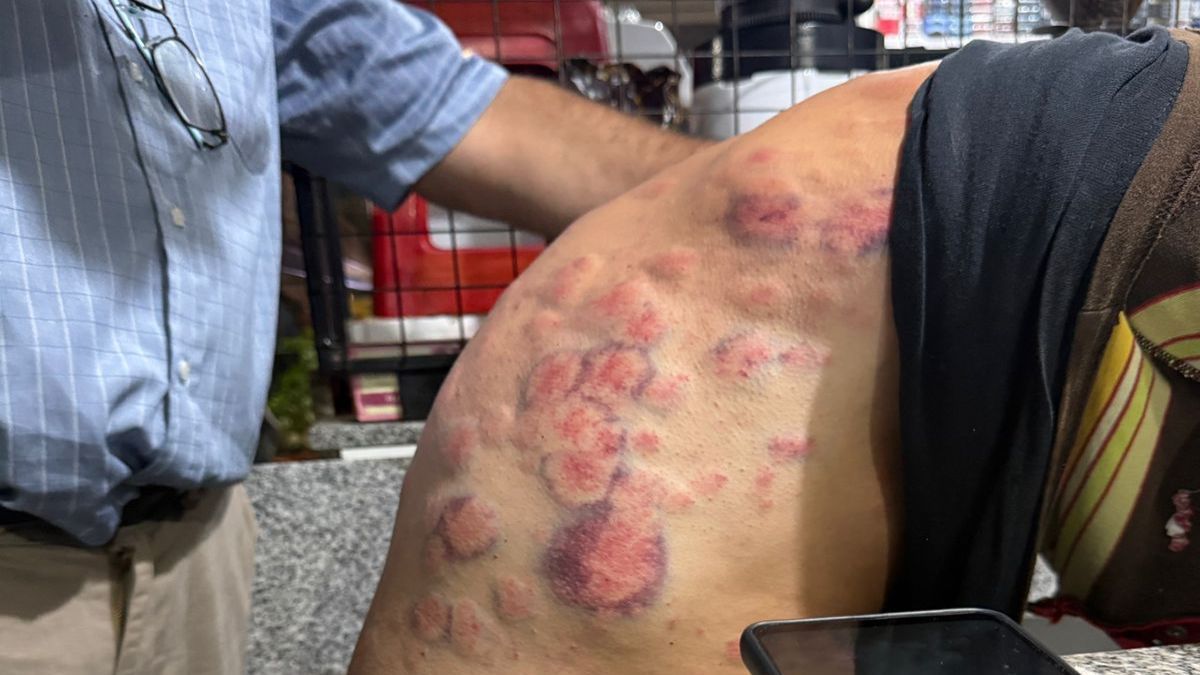 Un conductor, que estaba en el interior de su auto al momento de la tormenta, resultó herido. Un conductor, que estaba en el interior de su auto al momento de la tormenta, resultó herido.