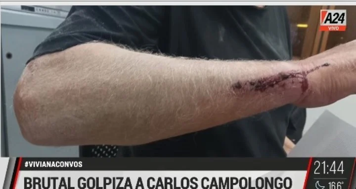 El fuerte ataque que sufrió el periodista Carlos Campolongo en la calle.