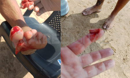 Mordedura de palometa en la Laguna Setúbal en febrero de 2023. Mordedura de palometa en la Laguna Setúbal en febrero de 2023.
