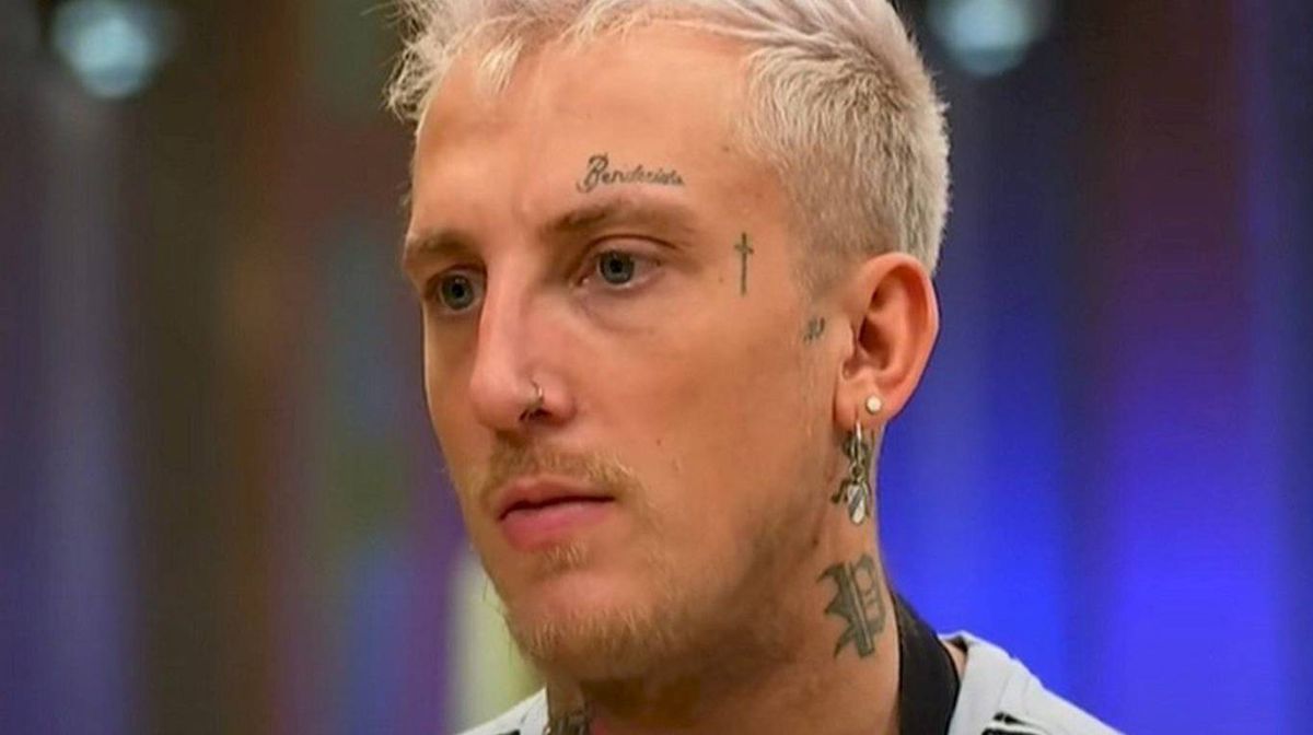 El Polaco reveló que no tiene un forúnculo. El Polaco reveló que no tiene un forúnculo.