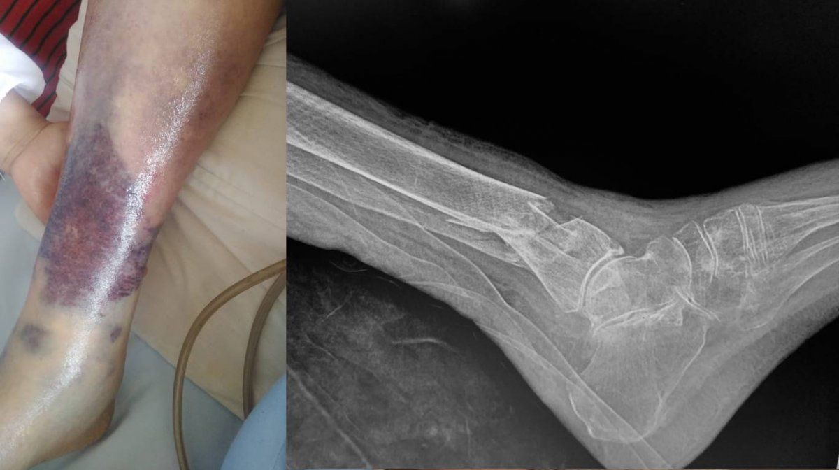 A los 103 años, Eva Mange sufre como nunca antes.