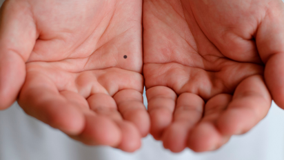 Quiromancia: los lunares de tu mano pueden revelar cosas sobre tu futuro