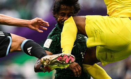 Yasir Al Shahrani, jugador de Arabia Saudita, sufrió múltiples fracturas en su rostor tras chocar con su compañero y serpa intervendio quirúrgicamente. Yasir Al Shahrani, jugador de Arabia Saudita, sufrió múltiples fracturas en su rostor tras chocar con su compañero y serpa intervendio quirúrgicamente.