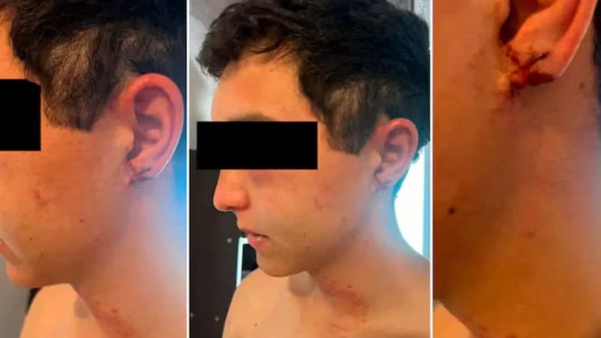 El joven fue acusado de un supuesto robo en el campo donde trabajaba.