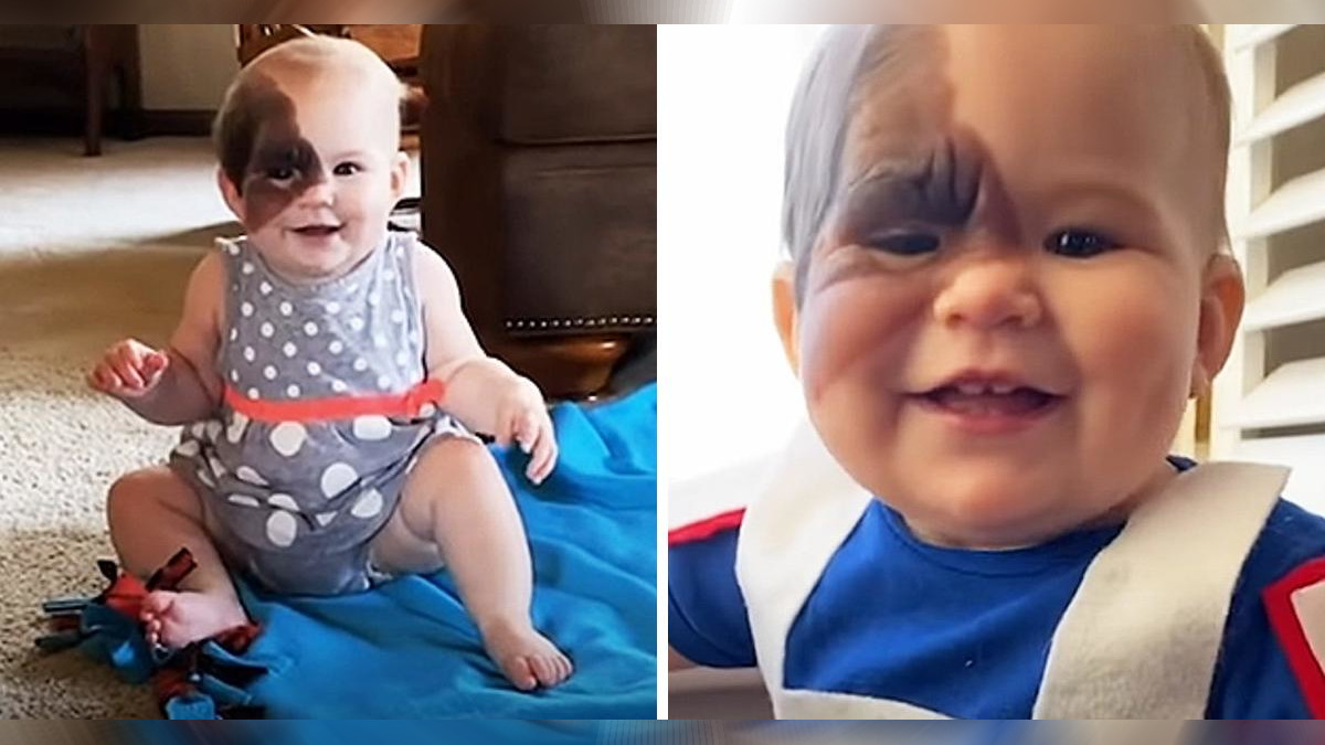 Mucha gente hostil se dedica a criticar y señalar la marca de nacimiento de su hija.