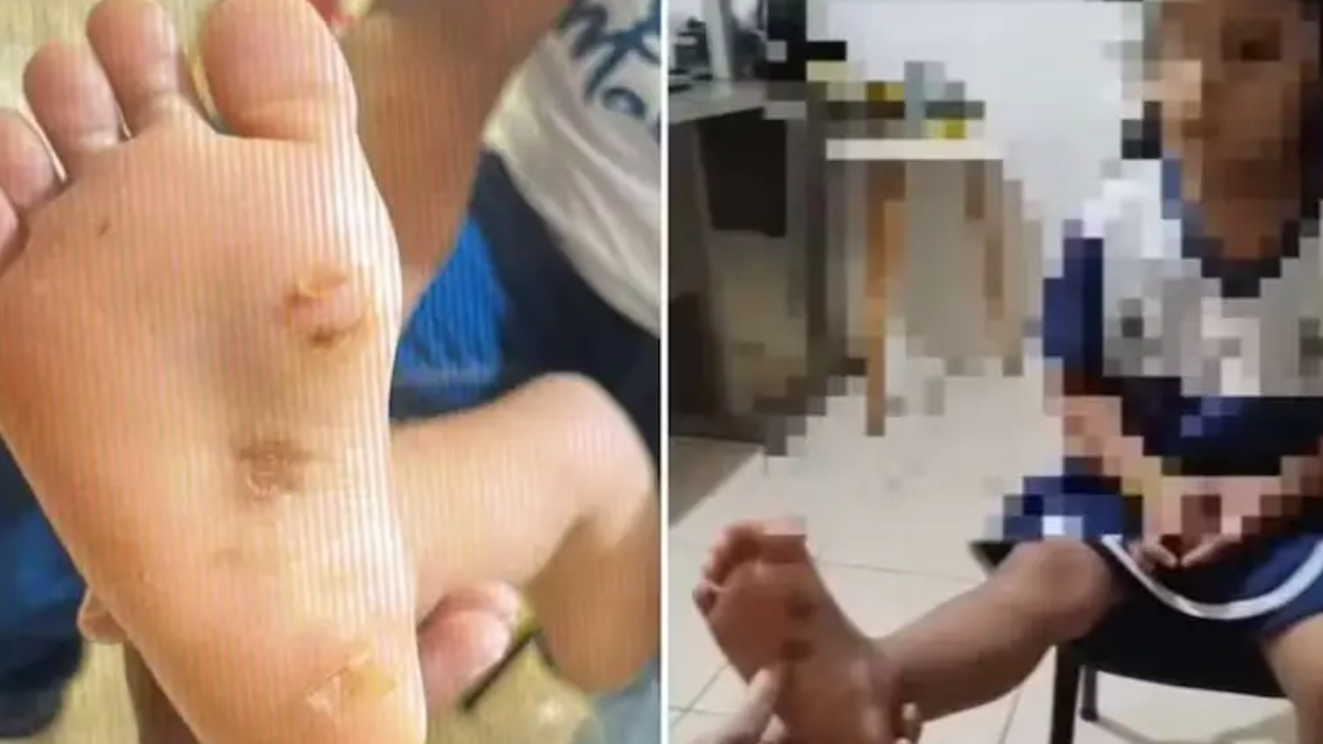 Detuvieron a una pareja acusada de torturar a su hija en Brasil la nena tenía quemaduras