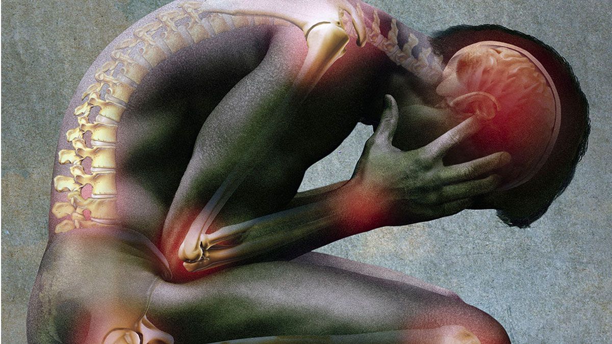 En Argentina se estima que 2 millones de personas sufren fibromialgia. Afecta mayoritariamente a las mujeres.&nbsp;