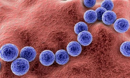 Streptococcus pyogenes es una bacteria de las cuales existen 80 serotipos diferentes. Streptococcus pyogenes es una bacteria de las cuales existen 80 serotipos diferentes.