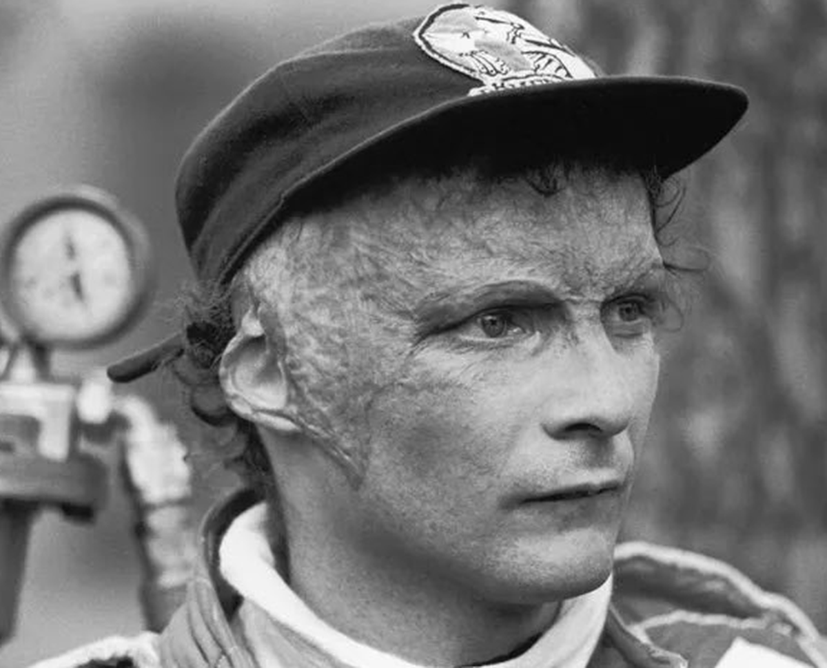 Para cubrir sus cicatrices en la cabeza, Lauda comenzaría a utilizar una gorra roja que, con los años, se volvió su característica distintiva, y hasta arreglaría con distintos sponsors para lucirlos en la misma.