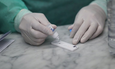 La prueba funcionaría analizando muestras de sangre para detectar ADN liberado por los tumores.