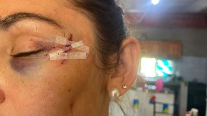 Habló la mujer atacada en San José del Rincón: 