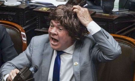 La imagen de Leiva con la peluca se volvió tendencia en las redes sociales. La imagen de Leiva con la peluca se volvió tendencia en las redes sociales.