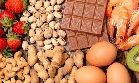 unos 250.000 ninos menores de cinco anos sufren alergias alimentarias en argentina unos 250.000 ninos menores de cinco anos sufren alergias alimentarias en argentina