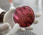 Investigadores de los Centros para el Control y la Prevención de Enfermedades (CDC) de EE.UU. descubrieron que un virus mortal llamado Chapare se puede contagiar de persona a persona Investigadores de los Centros para el Control y la Prevención de Enfermedades (CDC) de EE.UU. descubrieron que un virus mortal llamado Chapare se puede contagiar de persona a persona
