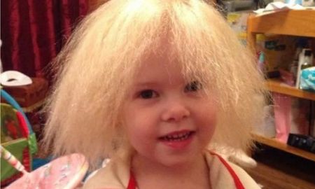 Lyla Grace: la nena que no se pudo peinar en 9 años debido a una extraña enfermedad Lyla Grace: la nena que no se pudo peinar en 9 años debido a una extraña enfermedad