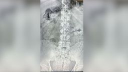 altText(Dos detenidos en la ruta 34 con más de 160 cápsulas de cocaína dentro de sus cuerpos)}