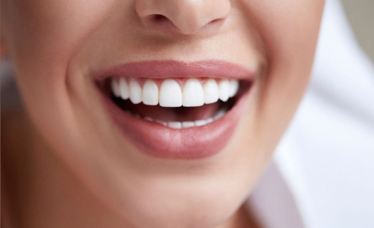 Qué pasa si me lavo los dientes con bicarbonato