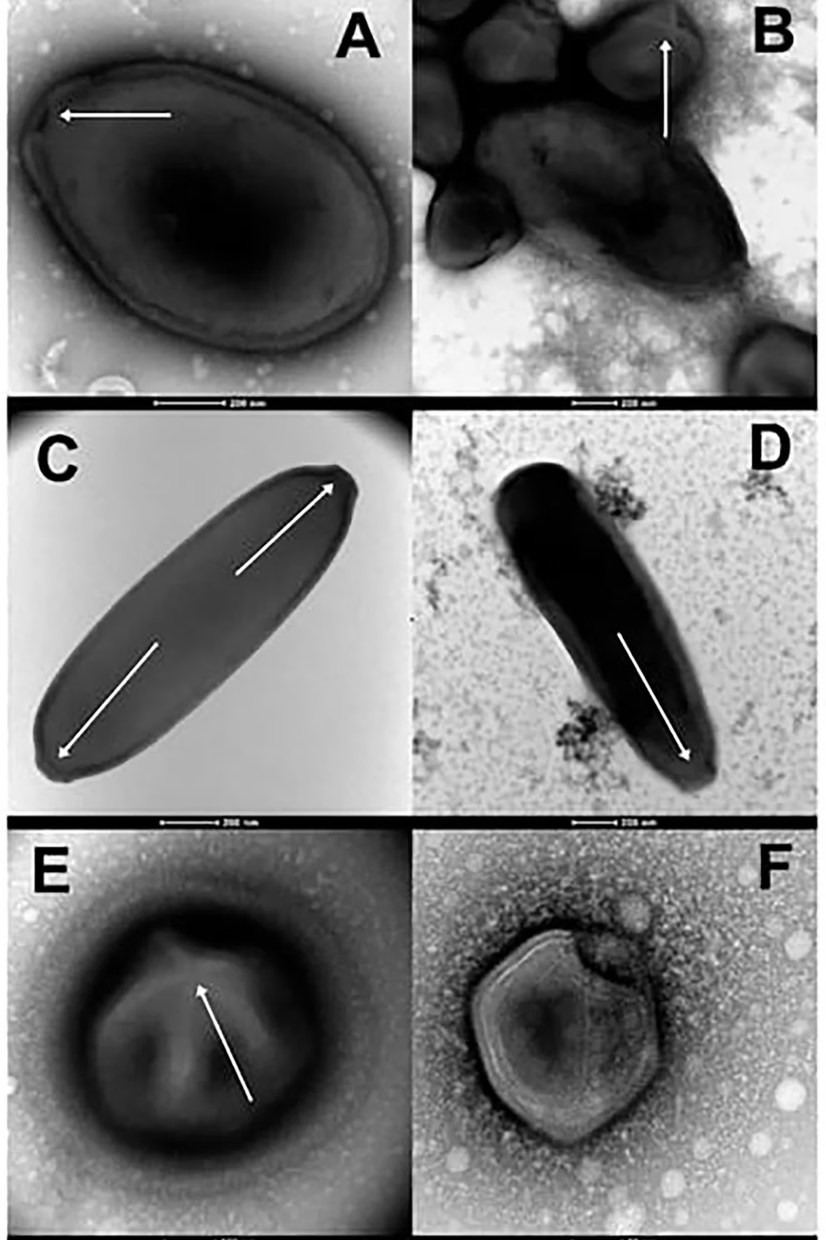Se trata de cinco nuevas familias de virus revividas, las cuales se suman a las dos anteriores. Entre estas siete familias, los expertos identificaron que la más antigua tiene casi 48.500 años (Jean-Michel Claverie, Universidad de Aix-Marseille en Marsella, Francia)
